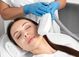 Acne Laser Treatments